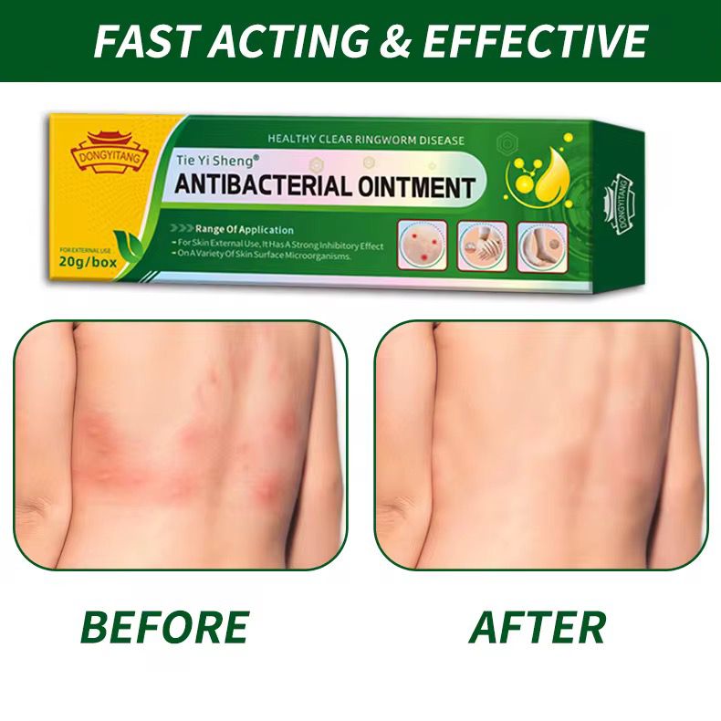 Crème Antibactérienne Naturelle