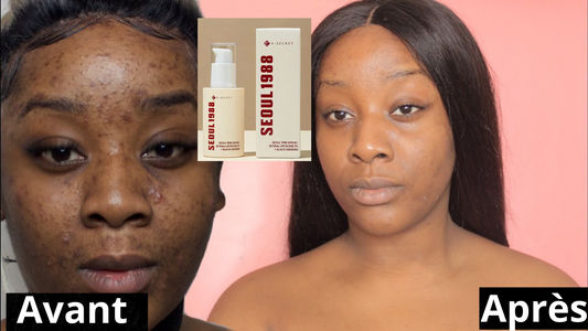 Sérum SEOUL 1988  –  hydrate, régénère et illumine la peau.